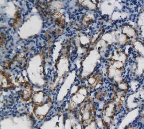 CXCL11 antibody