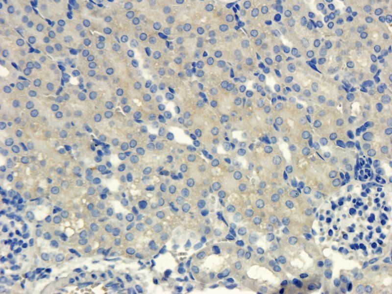 CXCL11 antibody