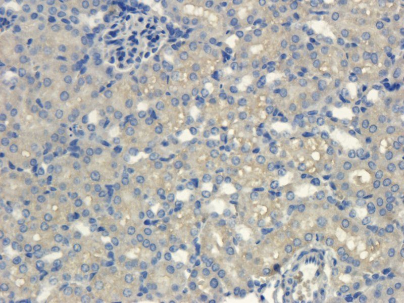 CXCL11 antibody