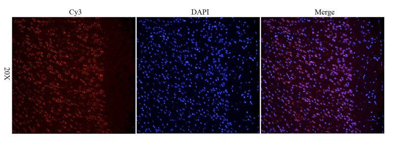 CXCL11 antibody