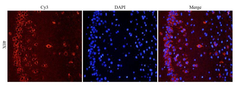 CXCL11 antibody