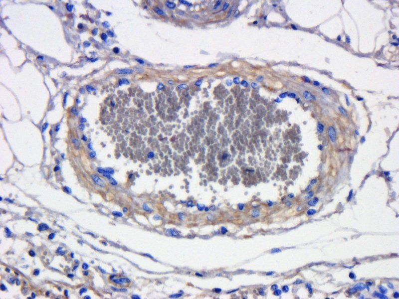 CXCL11 antibody