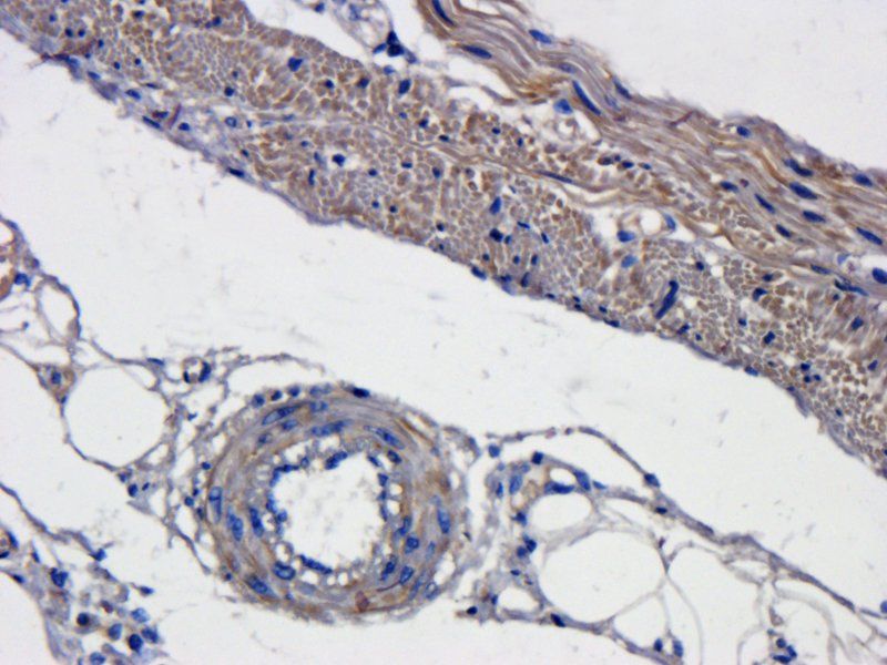 CXCL11 antibody