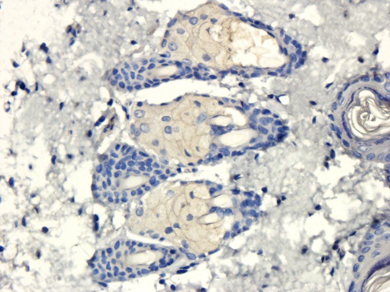 CXCL11 antibody