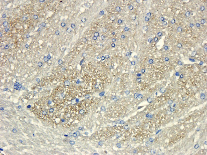 CXCL11 antibody