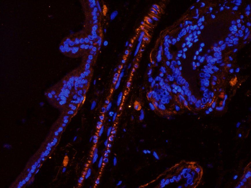 CXCL13 antibody