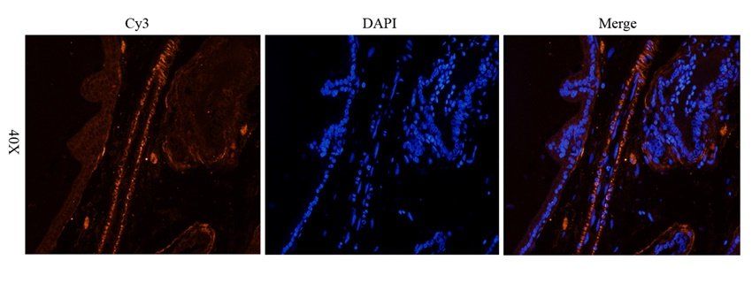 CXCL13 antibody