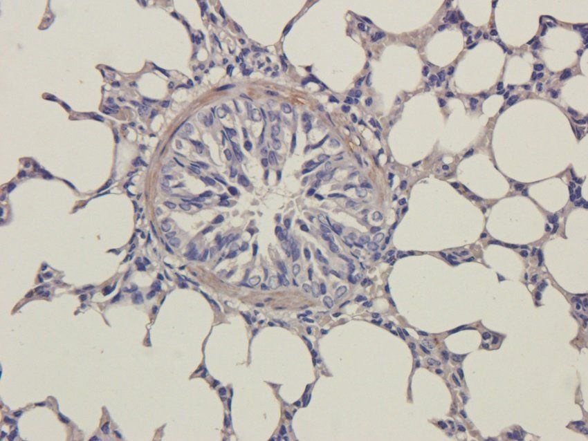 CXCL13 antibody