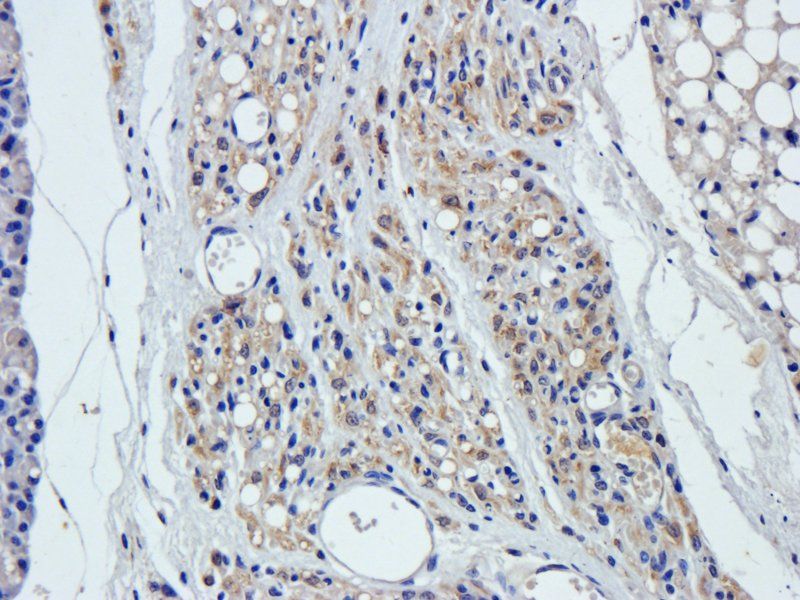 CXCL13 antibody