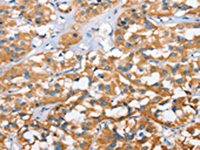 CXCL14 Antibody