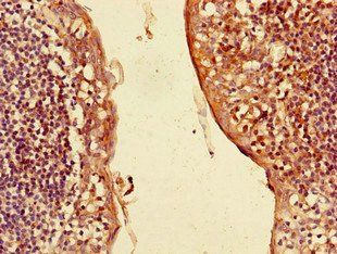 CXCL3 Antibody