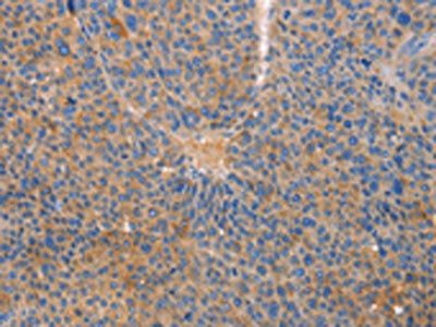 CXCL3 Antibody