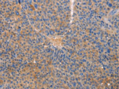 CXCL3 antibody