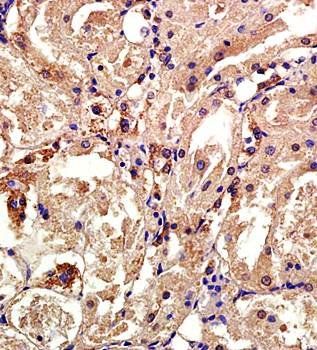 CXCL4 Rabbit Polyclonal Antibody