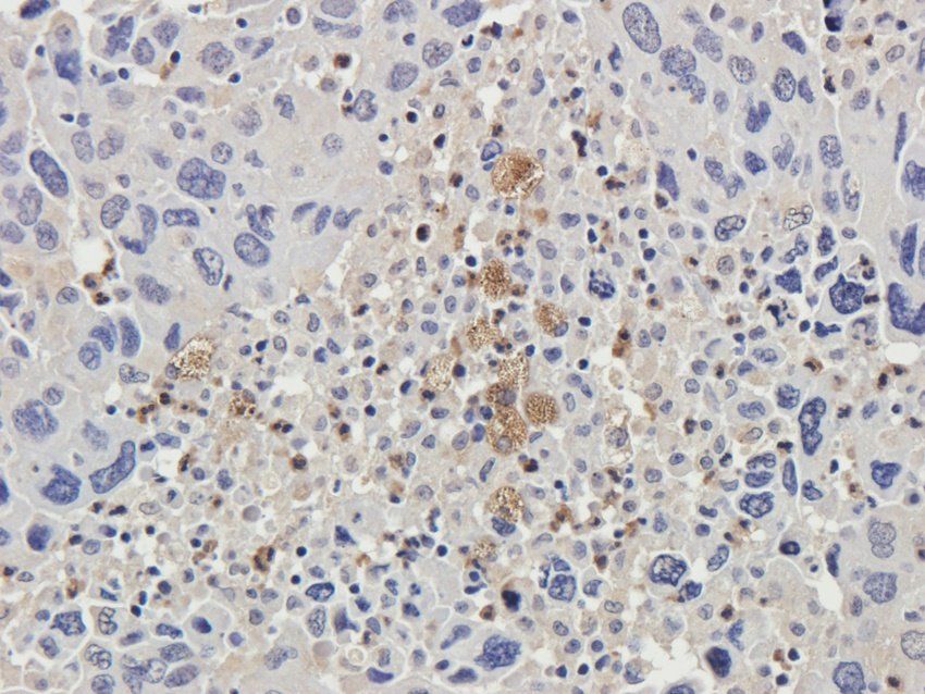 CXCL5 antibody