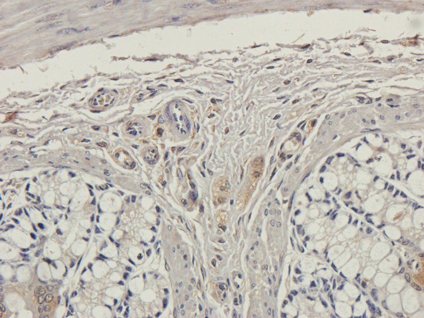 CXCL5 antibody