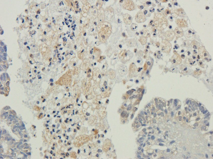 CXCL5 antibody