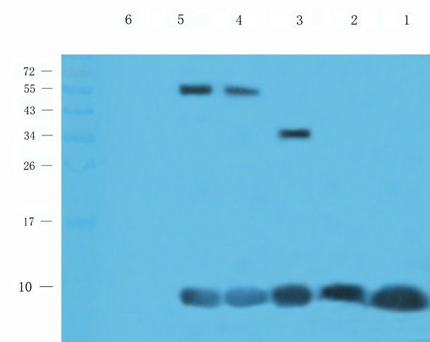 CXCL5 antibody