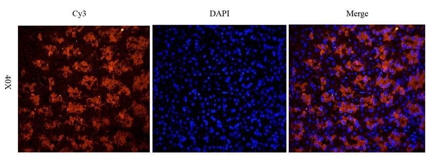 CXCL5 antibody