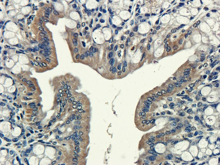 CXCL5 antibody