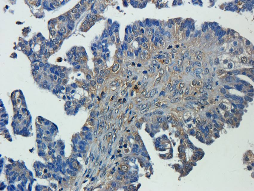 CXCL5 antibody