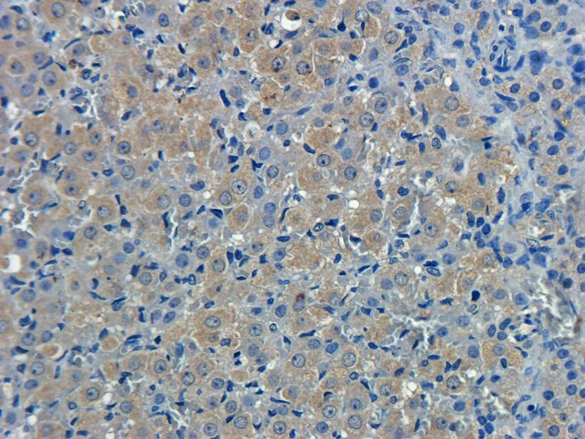 CXCL5 antibody