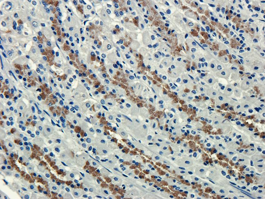 CXCL5 antibody