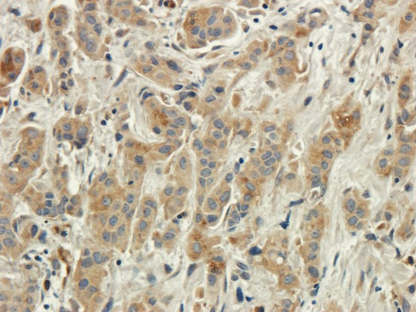 CXCL5 antibody