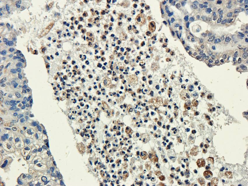 CXCL5 antibody