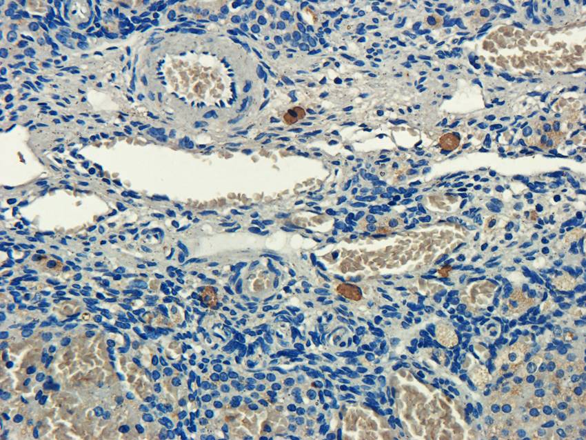 CXCL5 antibody