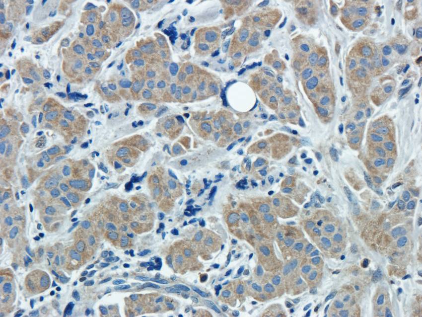 CXCL5 antibody