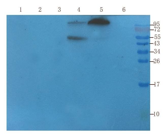 CXCL5 antibody