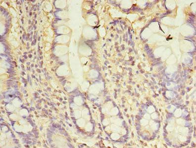 CXCL6 Antibody