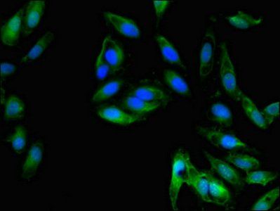 CXCL8 Antibody