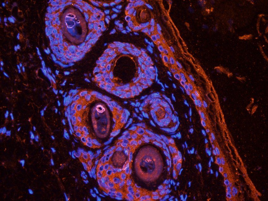 CXCR1 antibody