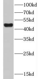 CXCR2 antibody