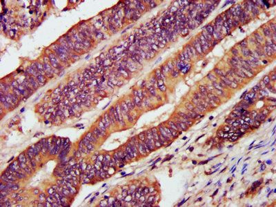 CXCR3 Antibody