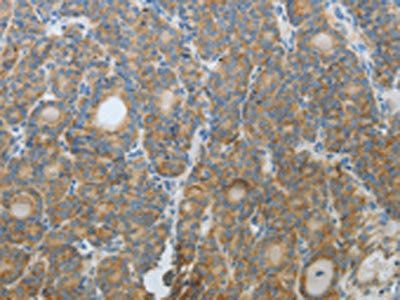 CXCR3 Antibody