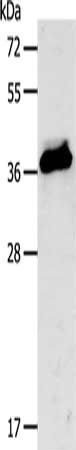 CXCR3 antibody