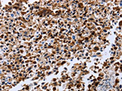 CXCR3 Antibody