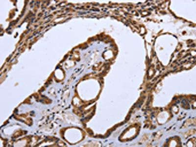 CXCR3 Antibody