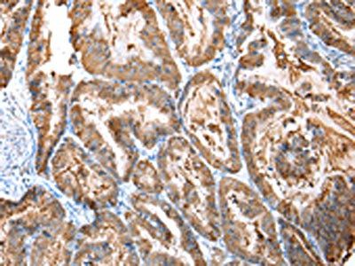 CXCR4 antibody