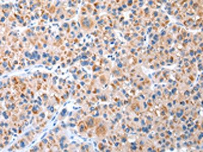 CXCR4 Antibody