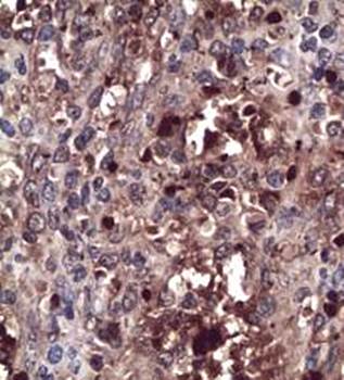 CXCR4 Rabbit Polyclonal Antibody