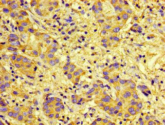 CXCR5 Antibody