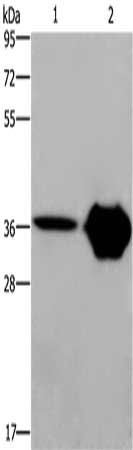 CXCR6 antibody