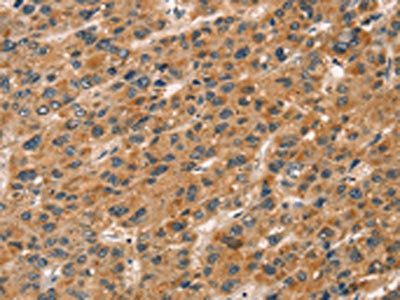 CXCR6 Antibody