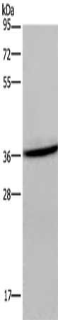 CXCR6 antibody