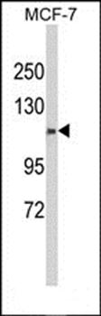 CXorf22 antibody