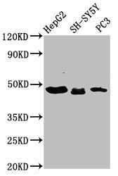 CXorf36 antibody